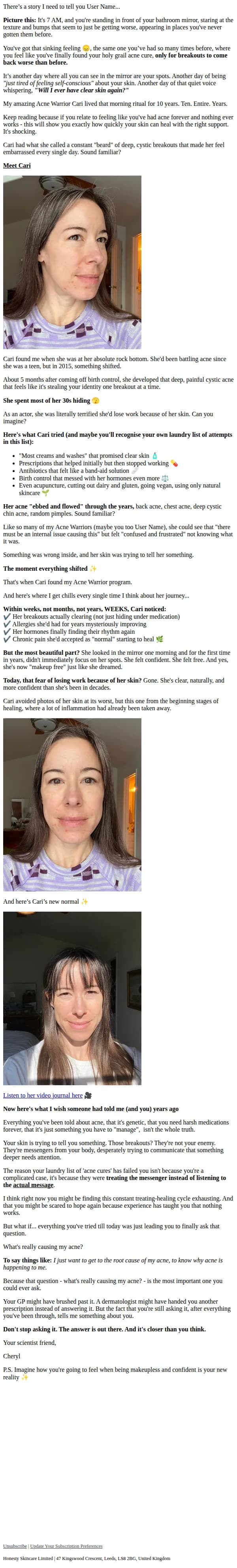 Cheryl Woodman email: What if clearing your acne wasn't so hard?